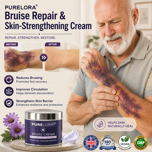 🥦Made in UK• 🚚 3-5 Day Delivery • 💯 180-Day Guarantee100K+ SOLD💕- PURELORA® Bruise Repair & Skin-Strengthening Cream